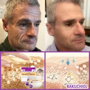 ❤️❤️FDA Official: Grunsify® 𝐐𝐮𝐞𝐞𝐧 𝐍𝐞𝐜𝐭𝐚𝐫 𝐏𝐞𝐩𝐭𝐢𝐝𝐞 + 𝐁𝐚𝐤𝐮𝐜𝐡𝐢𝐨𝐥 𝐒𝐤𝐢𝐧 𝐑𝐞𝐬𝐭𝐨𝐫𝐚𝐭𝐢𝐨𝐧 𝐂𝐫𝐞𝐚𝐦 - 𝐀𝐧𝐭𝐢-𝐚𝐠𝐢𝐧𝐠, 𝐇𝐲𝐝𝐫𝐚𝐭𝐢𝐧𝐠, 𝐒𝐤𝐢𝐧 𝐅𝐢𝐫𝐦𝐢𝐧𝐠 & 𝐋𝐢𝐟𝐭𝐢𝐧𝐠, 𝐒𝐤𝐢𝐧 𝐑𝐞𝐩𝐚𝐢𝐫, 𝐄𝐯𝐞𝐧 𝐓𝐨𝐧𝐞, 𝐀𝐜𝐧𝐞 𝐚𝐧𝐝 𝐃𝐚𝐫𝐤 𝐒𝐩𝐨𝐭 𝐓𝐫𝐞𝐚𝐭𝐦𝐞𝐧𝐭, 𝐖𝐚𝐫𝐭 𝐚𝐧𝐝 𝐌𝐨𝐥𝐞 𝐑𝐞𝐦𝐨𝐯𝐚𝐥, 𝐚𝐧𝐝 𝐏𝐬𝐨𝐫𝐢𝐚𝐬𝐢𝐬 𝐑𝐞𝐥𝐢𝐞𝐟.