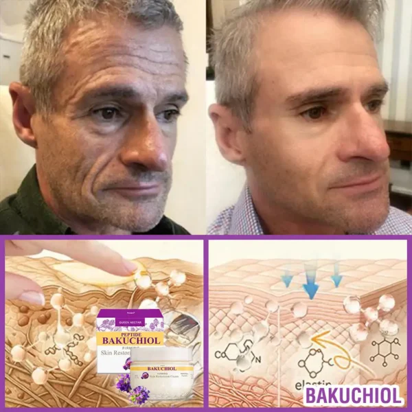 ❤️❤️FDA Official: Grunsify® 𝐐𝐮𝐞𝐞𝐧 𝐍𝐞𝐜𝐭𝐚𝐫 𝐏𝐞𝐩𝐭𝐢𝐝𝐞 + 𝐁𝐚𝐤𝐮𝐜𝐡𝐢𝐨𝐥 𝐒𝐤𝐢𝐧 𝐑𝐞𝐬𝐭𝐨𝐫𝐚𝐭𝐢𝐨𝐧 𝐂𝐫𝐞𝐚𝐦 - 𝐀𝐧𝐭𝐢-𝐚𝐠𝐢𝐧𝐠, 𝐇𝐲𝐝𝐫𝐚𝐭𝐢𝐧𝐠, 𝐒𝐤𝐢𝐧 𝐅𝐢𝐫𝐦𝐢𝐧𝐠 & 𝐋𝐢𝐟𝐭𝐢𝐧𝐠, 𝐒𝐤𝐢𝐧 𝐑𝐞𝐩𝐚𝐢𝐫, 𝐄𝐯𝐞𝐧 𝐓𝐨𝐧𝐞, 𝐀𝐜𝐧𝐞 𝐚𝐧𝐝 𝐃𝐚𝐫𝐤 𝐒𝐩𝐨𝐭 𝐓𝐫𝐞𝐚𝐭𝐦𝐞𝐧𝐭, 𝐖𝐚𝐫𝐭 𝐚𝐧𝐝 𝐌𝐨𝐥𝐞 𝐑𝐞𝐦𝐨𝐯𝐚𝐥, 𝐚𝐧𝐝 𝐏𝐬𝐨𝐫𝐢𝐚𝐬𝐢𝐬 𝐑𝐞𝐥𝐢𝐞𝐟.