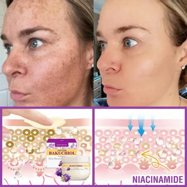 ❤️❤️FDA Official: Grunsify® 𝐐𝐮𝐞𝐞𝐧 𝐍𝐞𝐜𝐭𝐚𝐫 𝐏𝐞𝐩𝐭𝐢𝐝𝐞 + 𝐁𝐚𝐤𝐮𝐜𝐡𝐢𝐨𝐥 𝐒𝐤𝐢𝐧 𝐑𝐞𝐬𝐭𝐨𝐫𝐚𝐭𝐢𝐨𝐧 𝐂𝐫𝐞𝐚𝐦 - 𝐀𝐧𝐭𝐢-𝐚𝐠𝐢𝐧𝐠, 𝐇𝐲𝐝𝐫𝐚𝐭𝐢𝐧𝐠, 𝐒𝐤𝐢𝐧 𝐅𝐢𝐫𝐦𝐢𝐧𝐠 & 𝐋𝐢𝐟𝐭𝐢𝐧𝐠, 𝐒𝐤𝐢𝐧 𝐑𝐞𝐩𝐚𝐢𝐫, 𝐄𝐯𝐞𝐧 𝐓𝐨𝐧𝐞, 𝐀𝐜𝐧𝐞 𝐚𝐧𝐝 𝐃𝐚𝐫𝐤 𝐒𝐩𝐨𝐭 𝐓𝐫𝐞𝐚𝐭𝐦𝐞𝐧𝐭, 𝐖𝐚𝐫𝐭 𝐚𝐧𝐝 𝐌𝐨𝐥𝐞 𝐑𝐞𝐦𝐨𝐯𝐚𝐥, 𝐚𝐧𝐝 𝐏𝐬𝐨𝐫𝐢𝐚𝐬𝐢𝐬 𝐑𝐞𝐥𝐢𝐞𝐟.