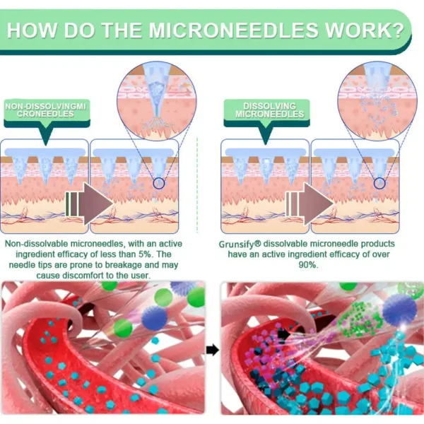 Grunsify® NIDDK-Tirzepatide Nano Microneedle Patch – FDA Certified Weight Loss Solution | 80% OFF Final Hours