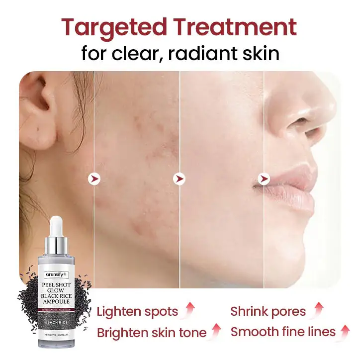 Grunsify® Peel Show Glow Black Rice Ampoule