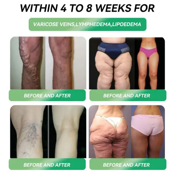 【LAST CHANCE!】Grunsify® NIDDK-Backed Patch – Melt 20lbs in Weeks (No Shots, No Sweat! 80% OFF TODAY ONLY!)