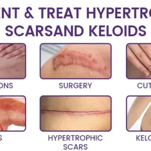 🔥 LIMITED SPECIAL OFFER Grunsify Scar Repair Gel