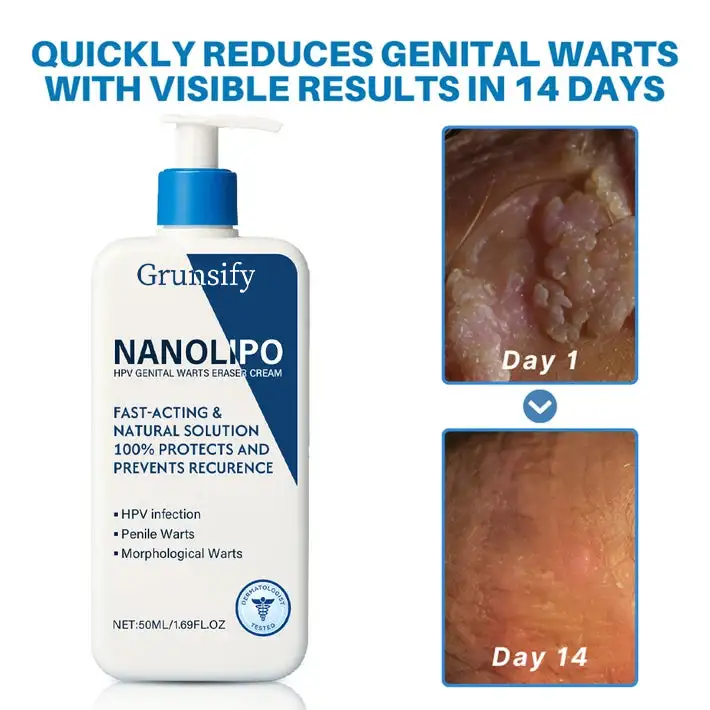 โ
Official Store: ๐ฅGrunsify NanoLipo HPV Genital Warts Eraser Cream Plus+