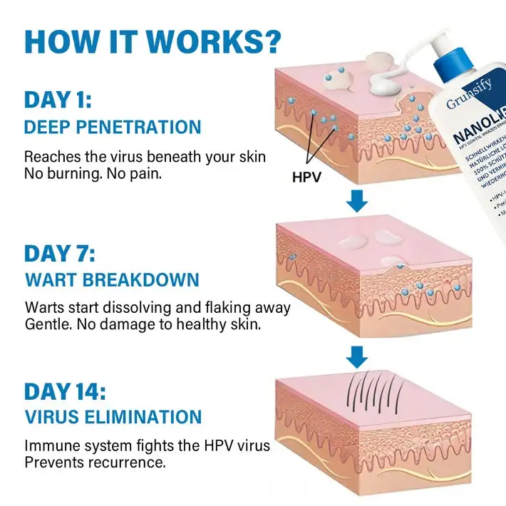 โ
Official Store: ๐ฅGrunsify NanoLipo HPV Genital Warts Eraser Cream Plus+